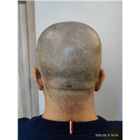 纹发机构哪家好__专业正规smp纹发机构-北京秃乐纹发-