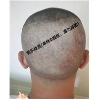 纹发