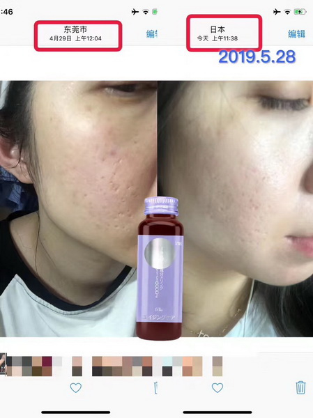 Tna美白