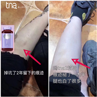 Tna美白抗糖饮