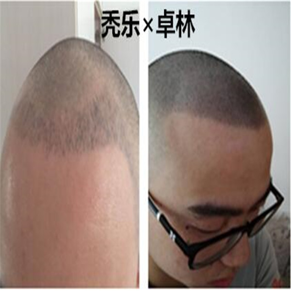 北京纹发培训机构、纹后效果是怎样的？