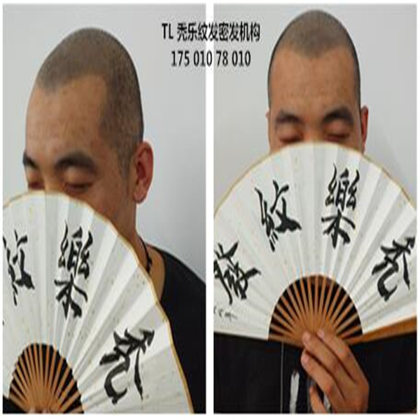 纹发, 北京纹发