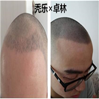 北京纹发培训机构、纹后效果是