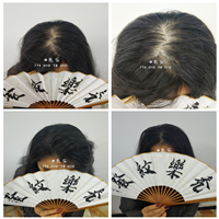 北京纹发价格、纹发机构