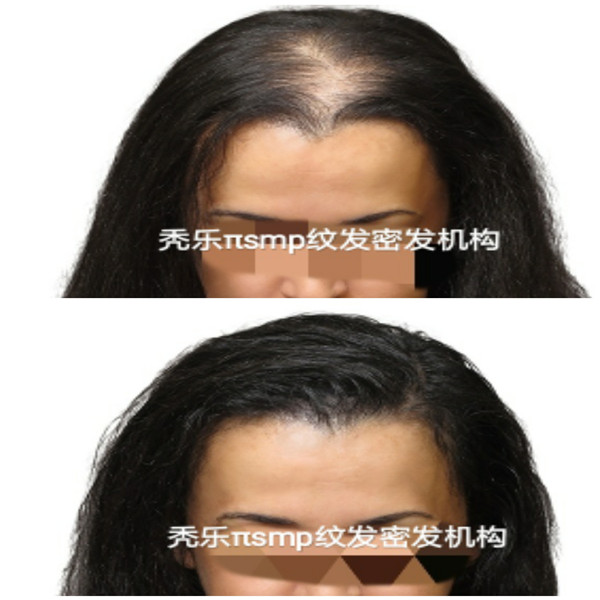 北京纹发|纹发机构