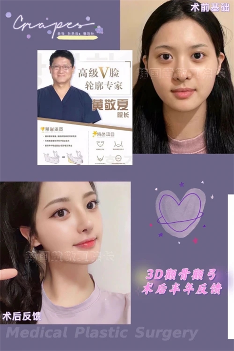 黄敬夏磨骨