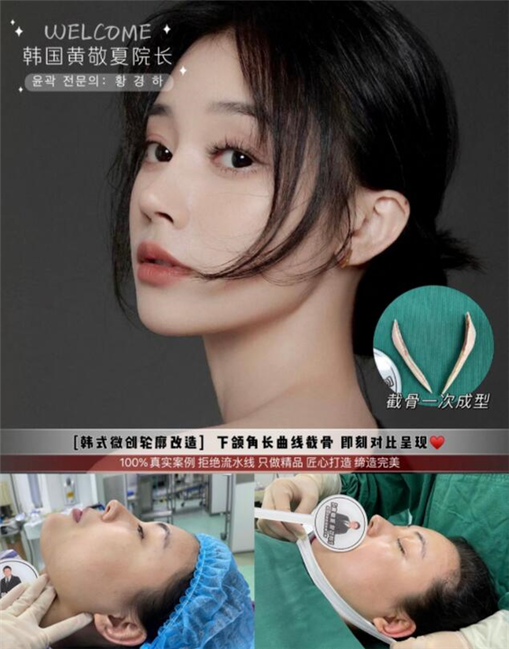 黄敬夏磨骨