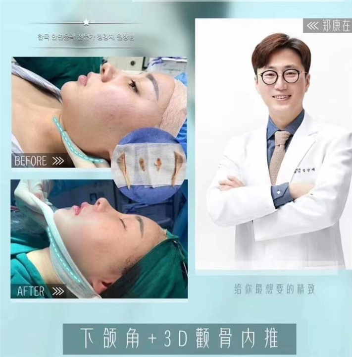 郑康在磨骨