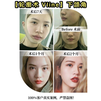 金一秀磨骨怎么样？