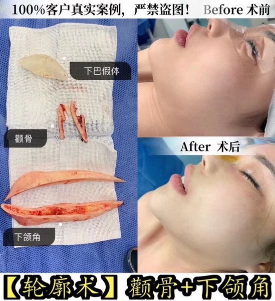 金一秀磨骨怎么样？