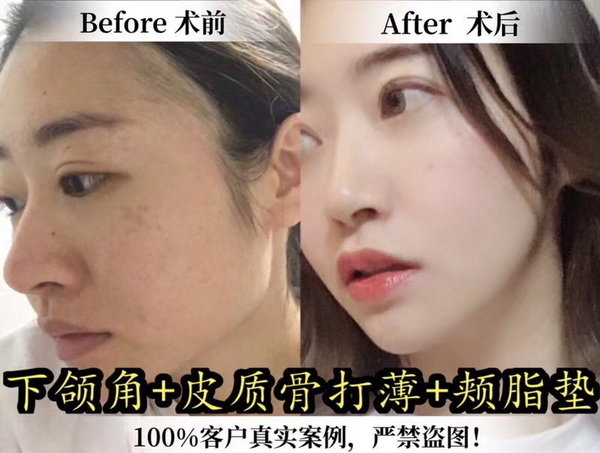 金一秀磨骨怎么样？