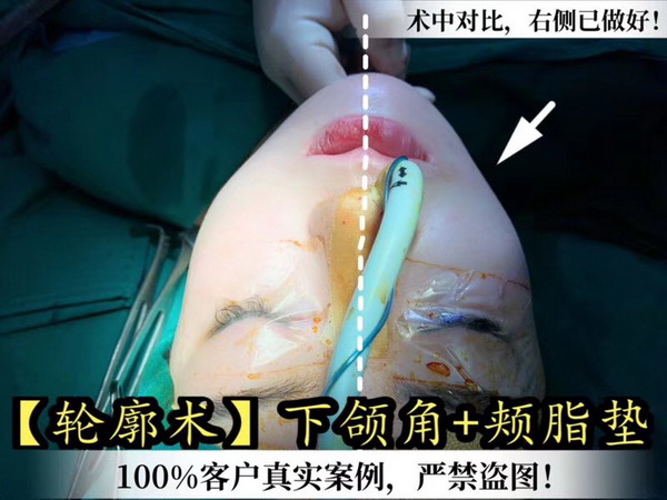 金一秀磨骨怎么样？