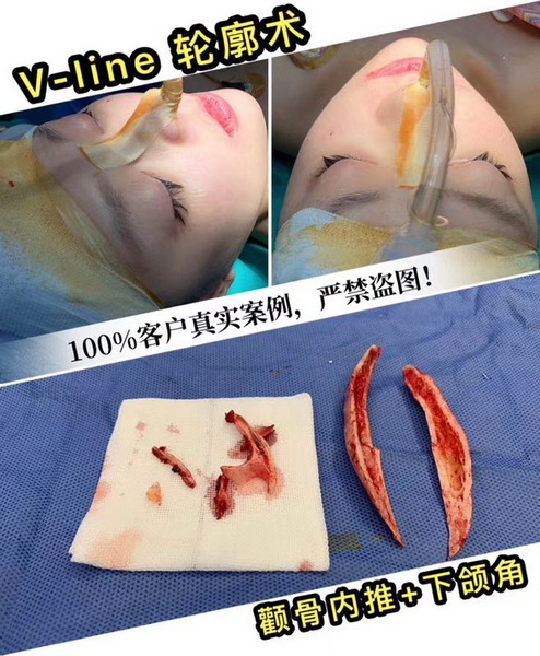 金一秀磨骨怎么样？
