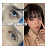 上海美丽之星眼综合整形