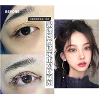 上海千美眼综合整形