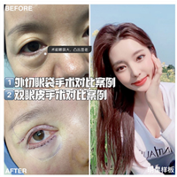 上海美莱连锁医疗眼整形