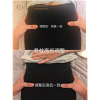 日式徒手整骨产后骨盆修复