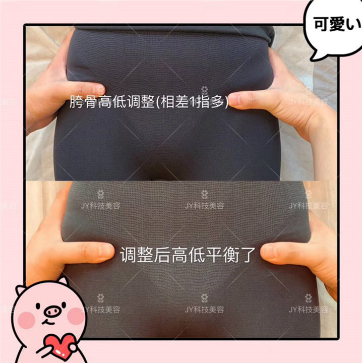 日式整骨_产后骨盆修复 