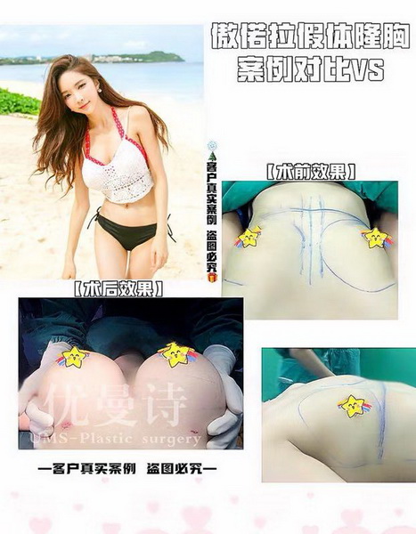 成都鼻整形专家
