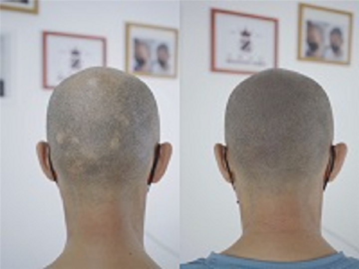 纹发后悔河北乌尊纹发老师告诉你影响纹发效果的几要素