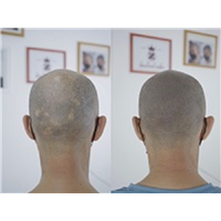 纹发后悔河北乌尊纹发老师告诉