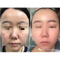 墨尔本专业抗衰美容