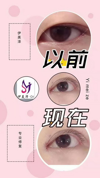 河南微整形培训学院