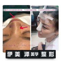 河南伊美泽修复医院