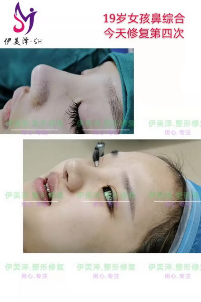 河南微整形培训学院哪家专业