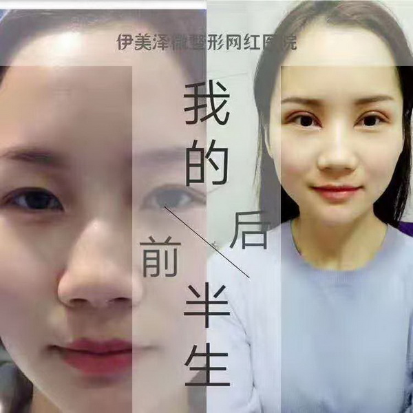 伊美泽微整形培训学院