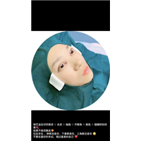 OV线雕脂肪移位培训