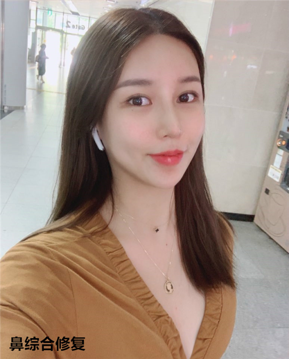 韩国可安美整形鼻综合修复 