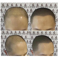 湖南3d纹发 