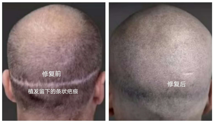 长沙纹发smp排名公司 