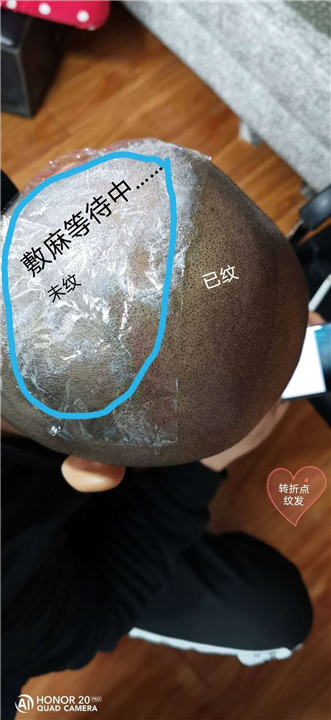 长沙smp纹发 