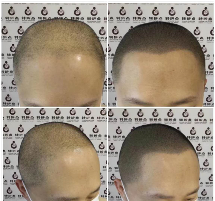 湖南3d纹发 