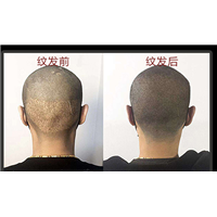 长沙纹发 