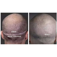 长沙纹发smp排名公司 