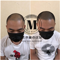 短发加密案例