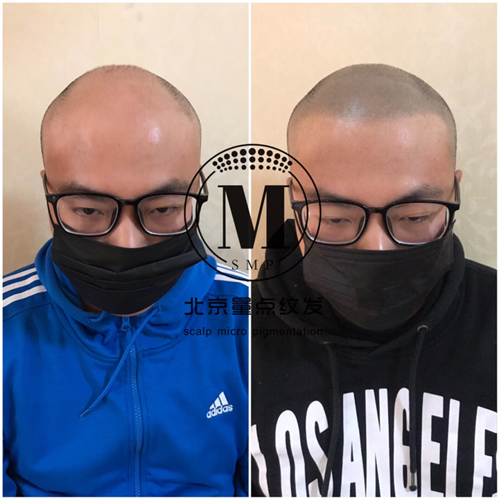 整头加密案例 