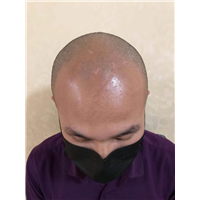 河北纹发 