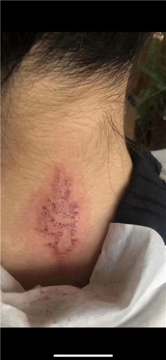 安顺洗纹身电话