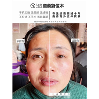 3D童颜复位术培训