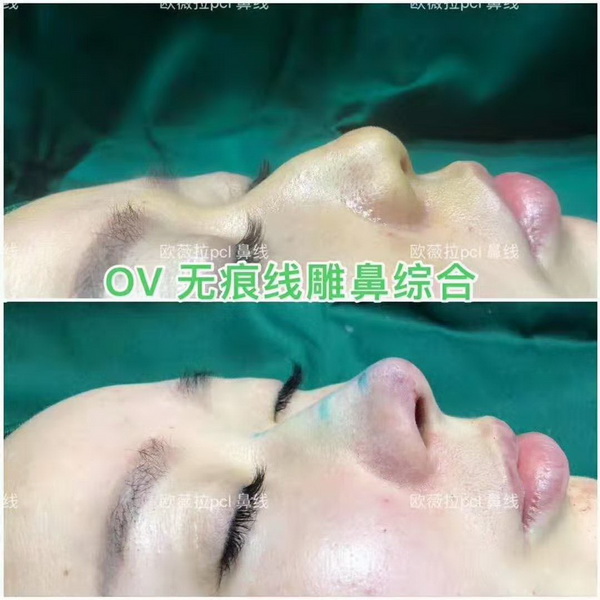 欧薇拉线雕