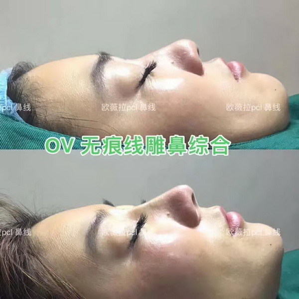 欧薇拉线雕