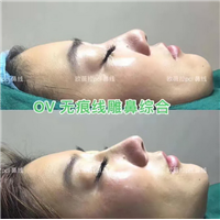 欧薇拉线雕