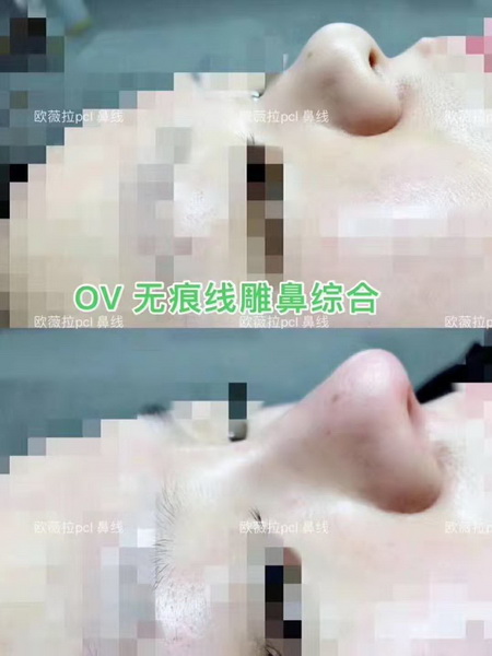 欧薇拉线雕