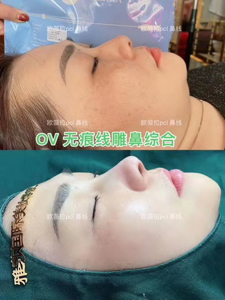 欧薇拉线雕