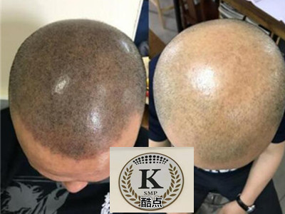 石家庄哪里有纹发_专业纹发