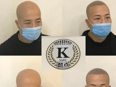 石家庄纹发哪家专业_专业纹发